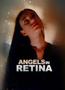 Retinal Angel